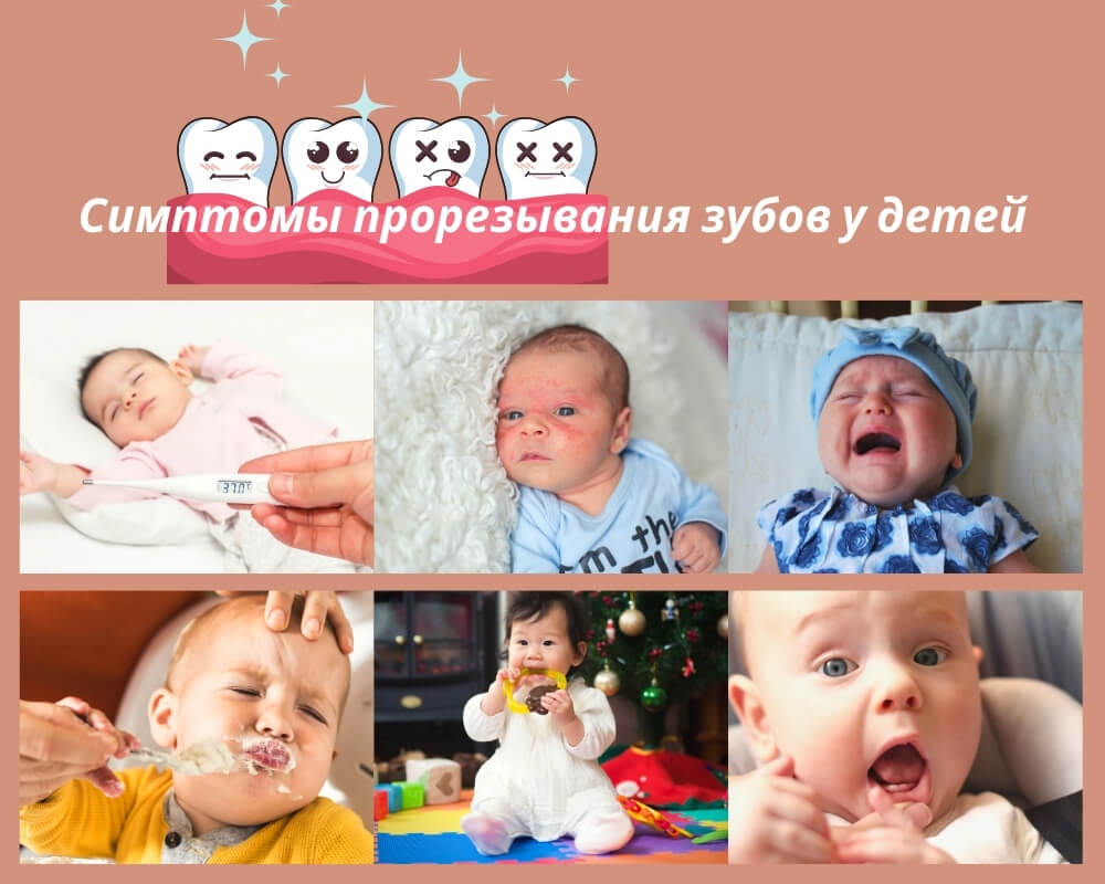 Симптомы прорезования зубов